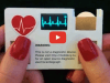 EKG-Gerät in Scheckkartengröße