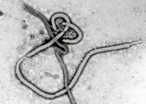 Ebola-Detektor