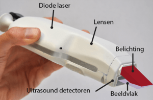 Handscanner voor echoscopie en fotoakoestiek