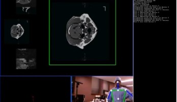 Une Kinect en salle d'opération