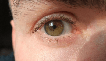 Lentilles de contact orwelliennes