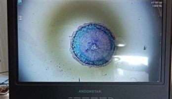 Andonstar AD210: un Conveniente Microscopio Digitale con Display da 10,1"