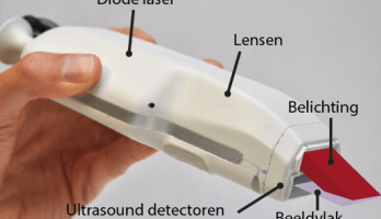 Handscanner voor echoscopie en fotoakoestiek