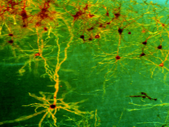 Neuro-imaging Reveals: Music Changes Brains