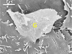 Graphene a Possible Health Hazard?