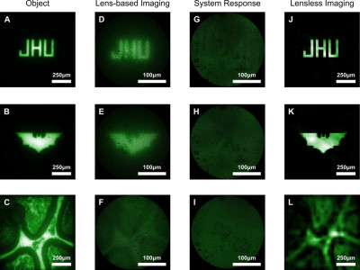 A - C: images of a normal microscope; D - F: conventional lens-based microendoscope; G - I: raw images of the new lensless microendoscope; J - L: after computational reconstruction. Image: Mark Foster, John Hopkins University.