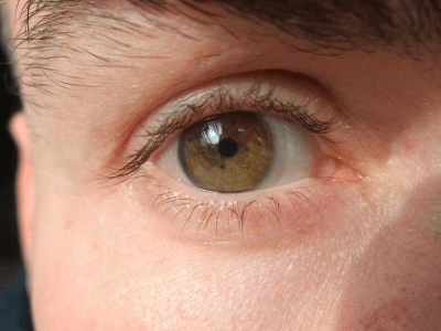 Orwellsche Innovationen: Solar-Kontaktlinsen von Google