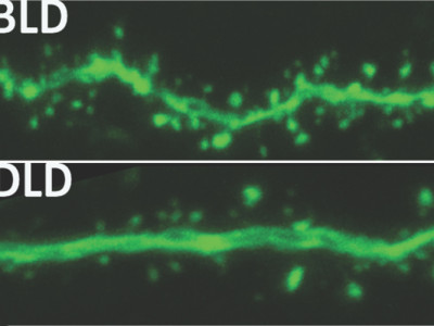 Gehirnaktivität bei normaler (oben) und gedimmter Beleuchtung (unten).
Bild: Michigan State University.