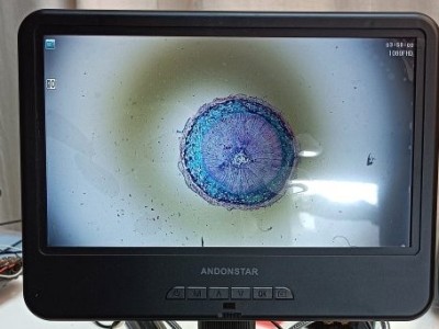 AD210 Andonstar : un Microscope Numérique Abordable avec un Écran 10.1"