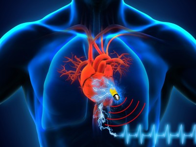 De nieuwe biologische supercondensator kan leiden tot pacemakers en andere implanteerbare apparaten die een leven lang meegaan (afbeelding: Islam Mosa/Universty of Connecticut en Maher El-Kady/UCLA).