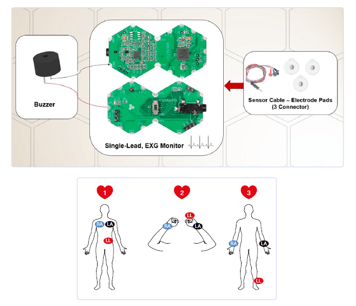 ECG monitoring