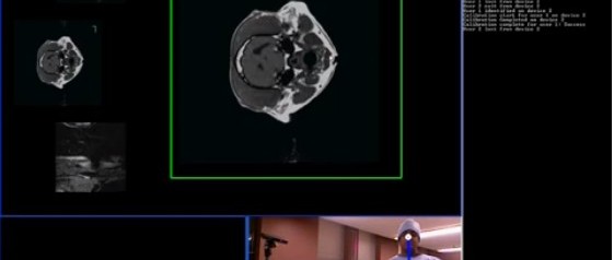 Une Kinect en salle d'opération