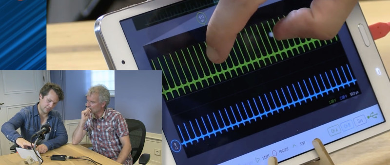 The innovative design of the SmartScope