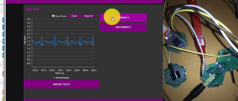 ECG Graph Monitoring