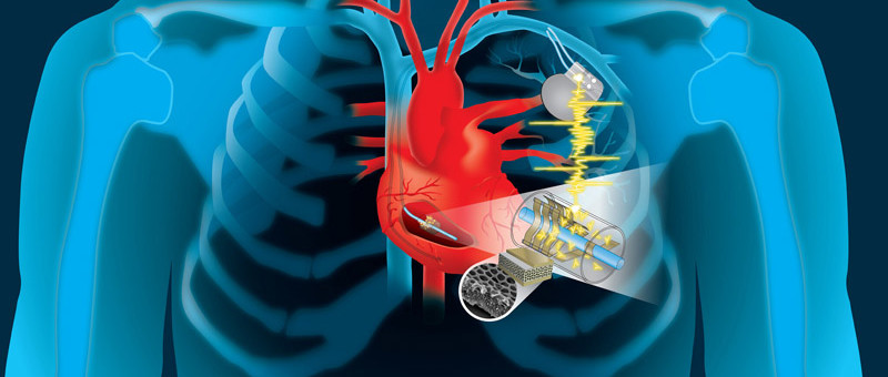 Beating heart charges implanted devices
