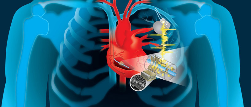 Herz versorgt Herzschrittmacher selbst
