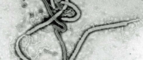 Ebola-Detektor