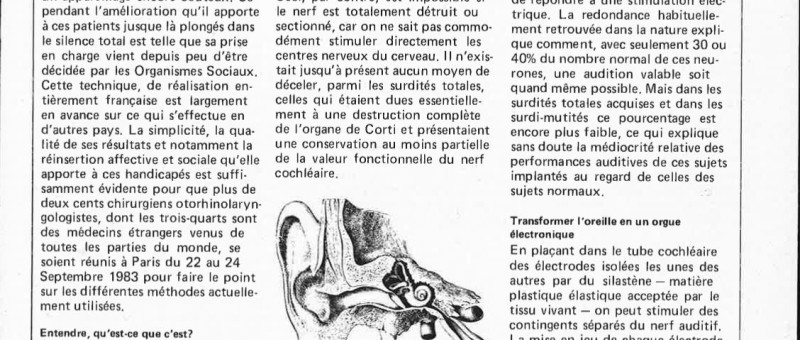 Selektor: Un procédé français permettant la réhabilitation chirurgicale des surdités totales