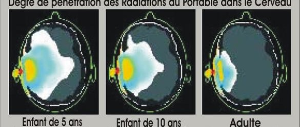 Téléphone mobile : plein la tête !