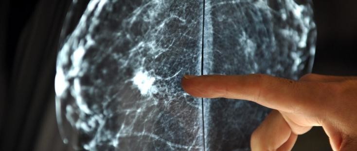 La révolution génétique