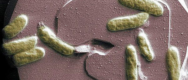 Durchbruch bei Biobatterien