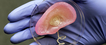 Une oreille bionique, quelle impression !