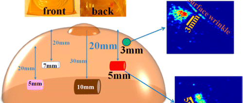Mieux qu’une mammographie : la peau artificielle
