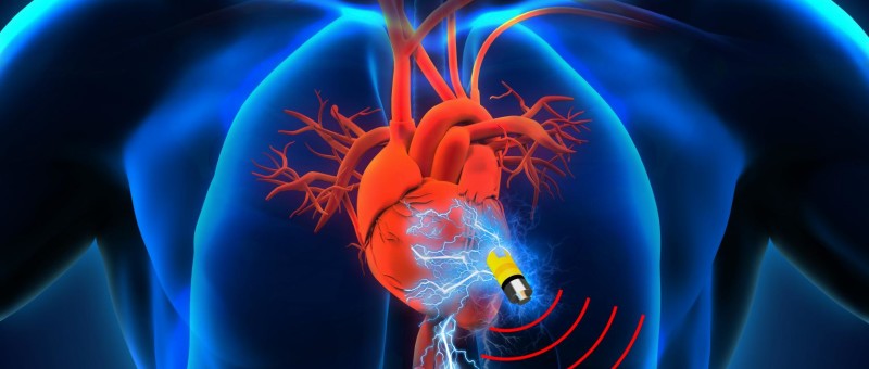 Supercondensateur biologique : pacemaker inépuisable