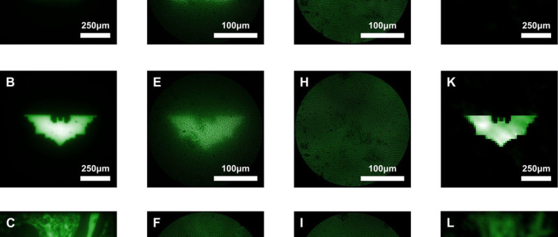 L'endoscope ultra-mince produit des images de haute qualité