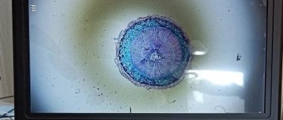 Andonstar AD210: un Conveniente Microscopio Digitale con Display da 10,1"
