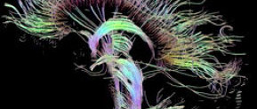 Tech The Future: Cognitieve neurowetenschap en muziek