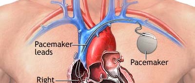 Un coeur en mouvement perpétuel