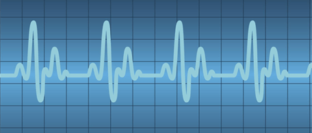 Het menselijk brein: een steil filter
