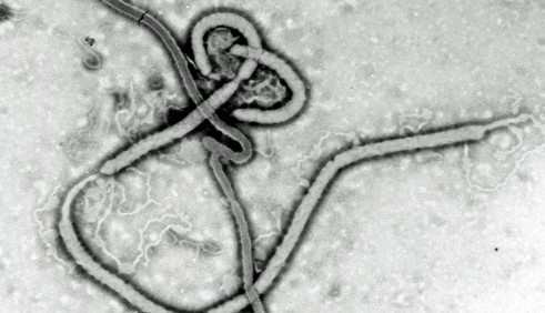 Ebola-Detektor