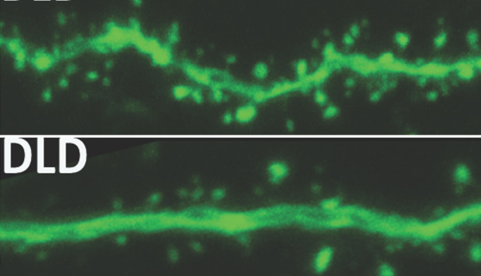 Gehirnaktivität bei normaler (oben) und gedimmter Beleuchtung (unten).
Bild: Michigan State University.