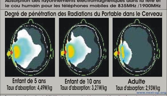 Téléphone mobile : plein la tête !