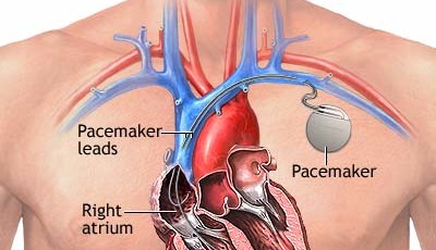 Un coeur en mouvement perpétuel