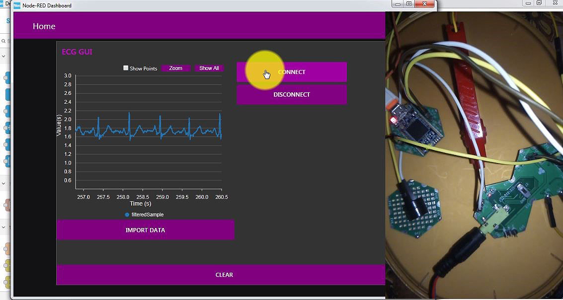 surveillance ECG