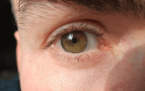 Lentilles de contact orwelliennes