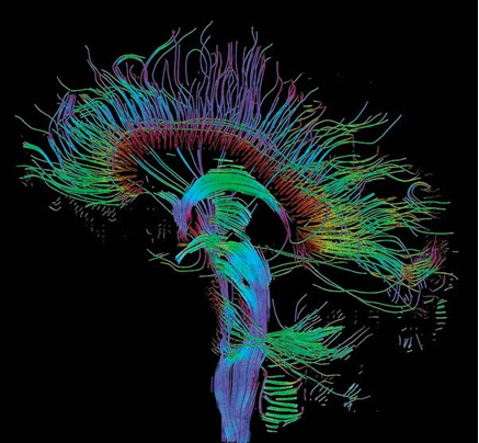 Neuro picture Neuro picture