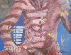 Als donatie slaagt, Gezondheid!