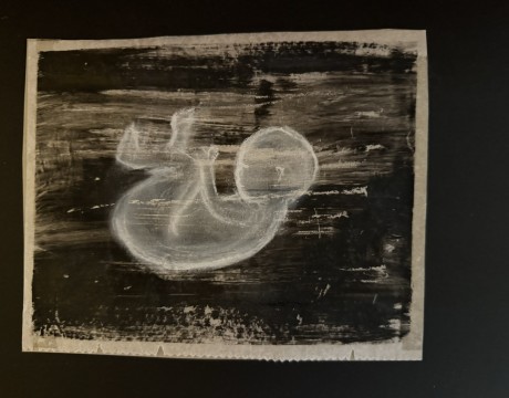 Kwetsbaar leven nog in totale verbondenheid